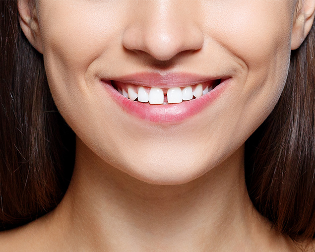 Image of cosmetic restoration service