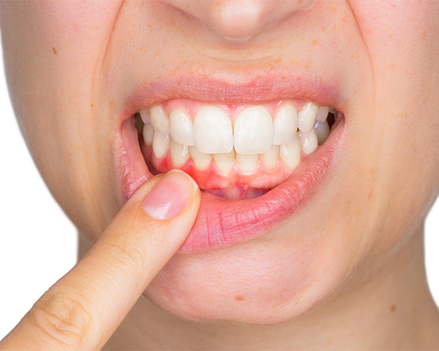 Image of Periodontics service