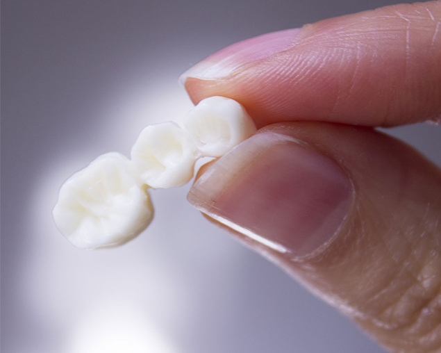 Image of prosthodontics service